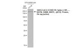 SARS/SARS-CoV-2 Spike Protein S2 Antibody in Western Blot (WB)