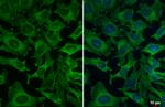 VPS35 Antibody in Immunocytochemistry (ICC/IF)