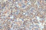 VPS35 Antibody in Immunohistochemistry (Paraffin) (IHC (P))