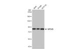 VPS35 Antibody in Western Blot (WB)