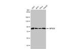 VPS35 Antibody in Western Blot (WB)