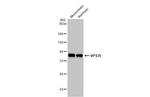 VPS35 Antibody in Western Blot (WB)