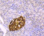 Chromogranin A Antibody in Immunohistochemistry (Paraffin) (IHC (P))