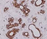 Cytokeratin 7 Antibody in Immunohistochemistry (Paraffin) (IHC (P))