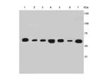 Cytokeratin 7 Antibody in Western Blot (WB)