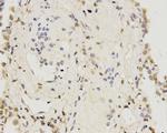 IFNAR1 Antibody in Immunohistochemistry (Paraffin) (IHC (P))