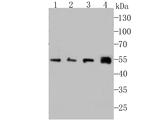 IFNAR1 Antibody in Western Blot (WB)