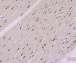 NFIB Antibody in Immunohistochemistry (Paraffin) (IHC (P))