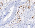 Myeloperoxidase Antibody in Immunohistochemistry (Paraffin) (IHC (P))