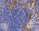 Cytokeratin 14 Antibody in Immunohistochemistry (Paraffin) (IHC (P))