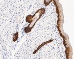 Cytokeratin 14 Antibody in Immunohistochemistry (Paraffin) (IHC (P))