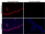 Cytokeratin 14 Antibody in Immunohistochemistry (Paraffin) (IHC (P))