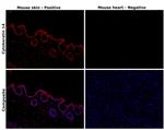 Cytokeratin 14 Antibody in Immunohistochemistry (Paraffin) (IHC (P))