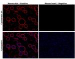 Cytokeratin 14 Antibody