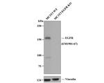 EGFR Antibody in Western Blot (WB)