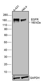 EGFR Antibody in Western Blot (WB)