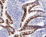 Cytokeratin 20 Antibody in Immunohistochemistry (Paraffin) (IHC (P))