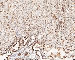 MSH6 Antibody in Immunohistochemistry (Paraffin) (IHC (P))