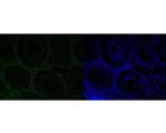 MSH6 Antibody in Immunohistochemistry (Paraffin) (IHC (P))