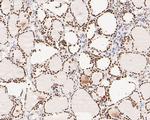 MSH6 Antibody in Immunohistochemistry (Paraffin) (IHC (P))