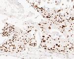 MSH6 Antibody in Immunohistochemistry (Paraffin) (IHC (P))