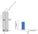 Glutamine Synthetase Antibody in Western Blot (WB)