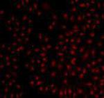 BMI-1 Antibody in Immunocytochemistry (ICC/IF)