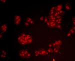 BMI-1 Antibody in Immunocytochemistry (ICC/IF)