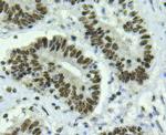 BMI-1 Antibody in Immunohistochemistry (Paraffin) (IHC (P))