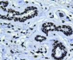 BMI-1 Antibody in Immunohistochemistry (Paraffin) (IHC (P))