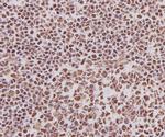 Ku70 Antibody in Immunohistochemistry (Paraffin) (IHC (P))