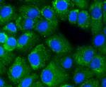 NFkB p65 Antibody in Immunocytochemistry (ICC/IF)