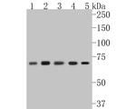 NFkB p65 Antibody in Western Blot (WB)