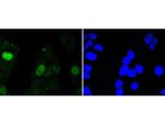 Survivin Antibody in Immunocytochemistry (ICC/IF)