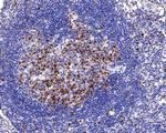 Survivin Antibody in Immunohistochemistry (Paraffin) (IHC (P))