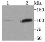 STAT6 Antibody in Western Blot (WB)