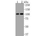 STAT6 Antibody in Western Blot (WB)