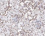 Phospho-JAK2 (Tyr1007, Tyr1008) Antibody in Immunohistochemistry (Paraffin) (IHC (P))