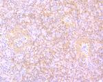 B-Raf Antibody in Immunohistochemistry (Paraffin) (IHC (P))