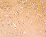 B-Raf Antibody in Immunohistochemistry (Paraffin) (IHC (P))