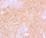 B-Raf Antibody in Immunohistochemistry (Paraffin) (IHC (P))