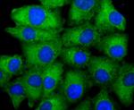 ASK1 Antibody in Immunocytochemistry (ICC/IF)