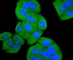 ASK1 Antibody in Immunocytochemistry (ICC/IF)