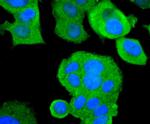 ASK1 Antibody in Immunocytochemistry (ICC/IF)