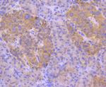 ASK1 Antibody in Immunohistochemistry (Paraffin) (IHC (P))