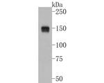 ASK1 Antibody in Western Blot (WB)