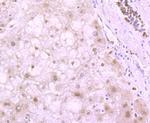 H4K20me3 Antibody in Immunohistochemistry (Paraffin) (IHC (P))