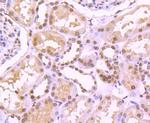 H4K20me3 Antibody in Immunohistochemistry (Paraffin) (IHC (P))