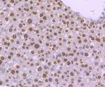 H4K20me3 Antibody in Immunohistochemistry (Paraffin) (IHC (P))