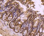 H4K20me3 Antibody in Immunohistochemistry (Paraffin) (IHC (P))